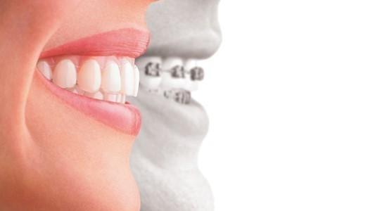 Retention follow-up visits