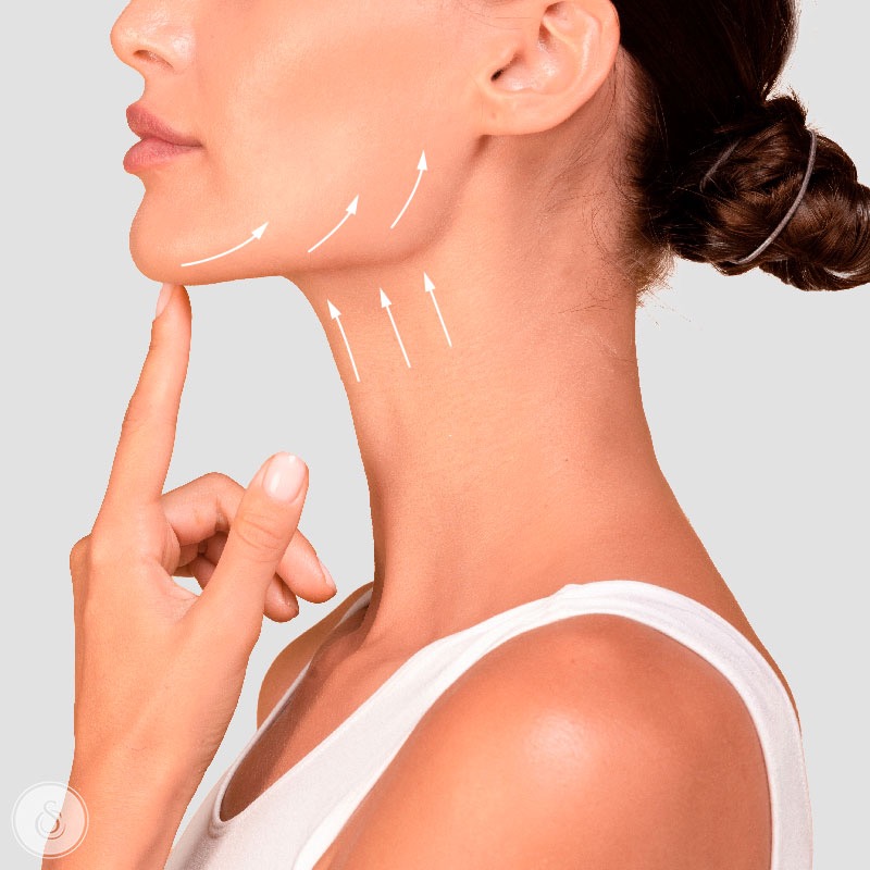 Nefertiti lift ( neck muscle botox)