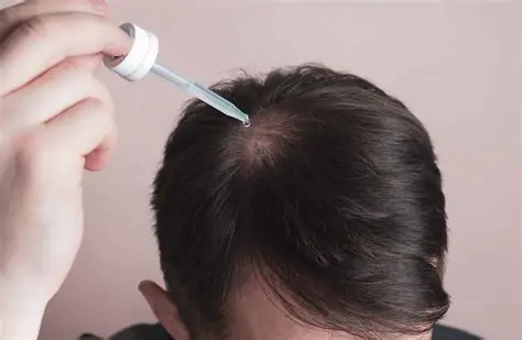 Hair loss treatment