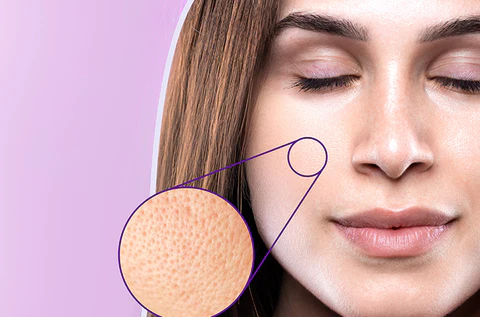 Open pores treatment