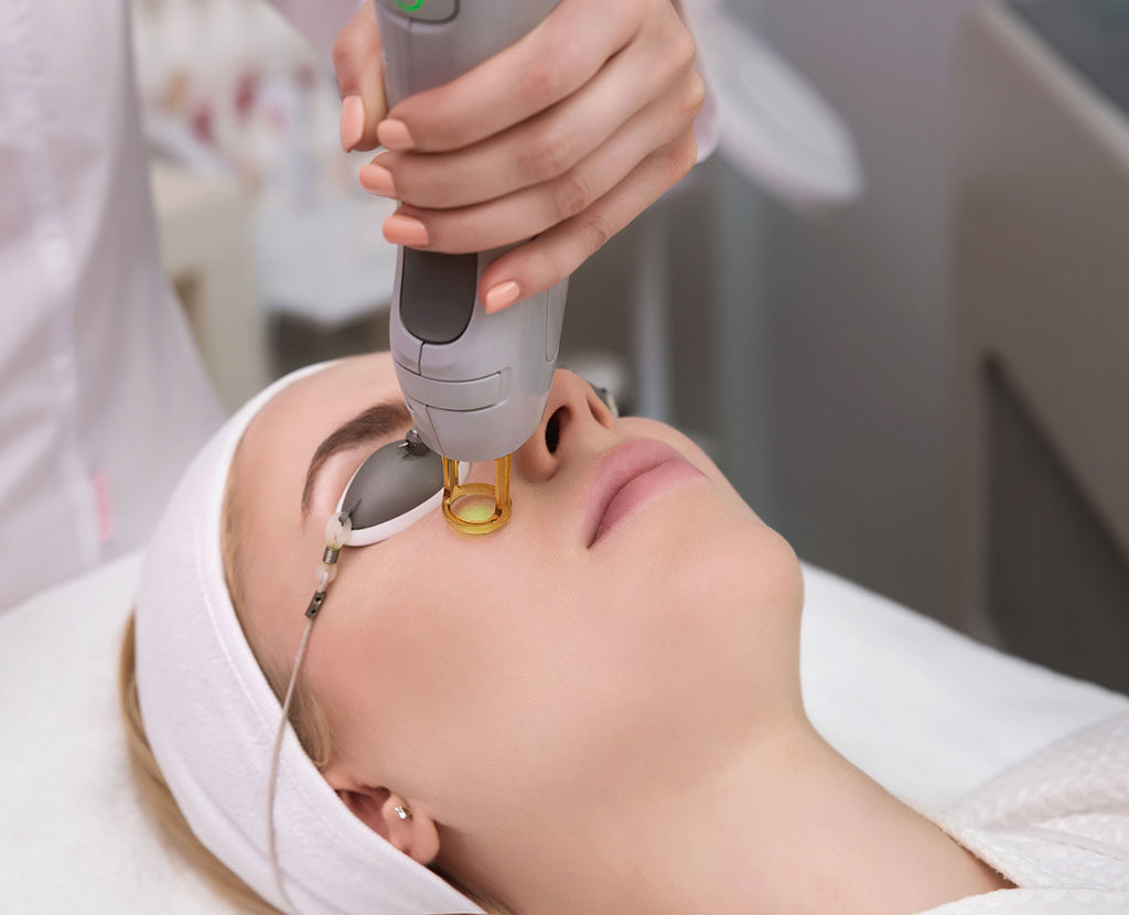Resurfacing laser treatments