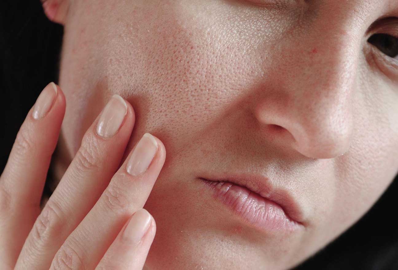 skinpores