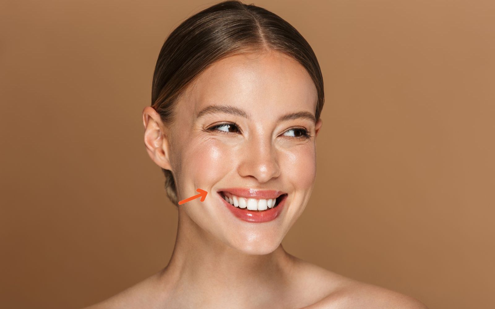 smile lines