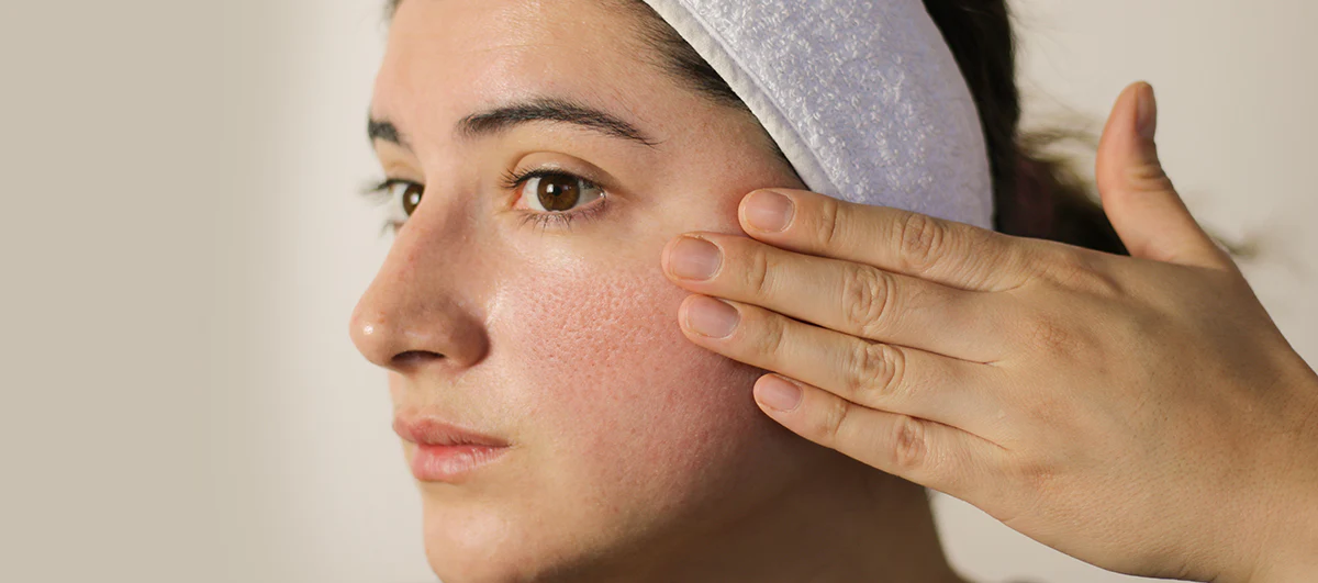 large pores