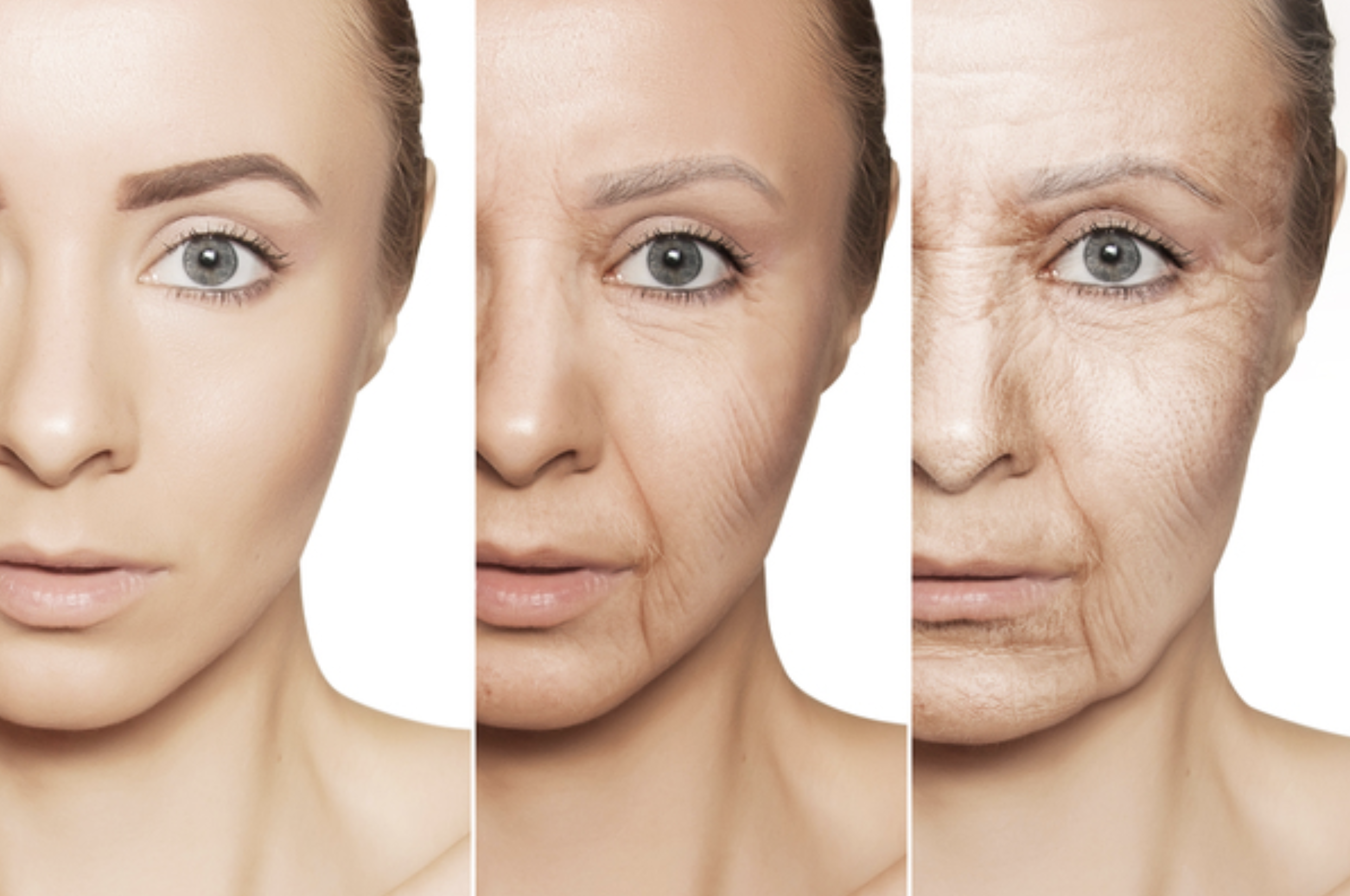 facial aging