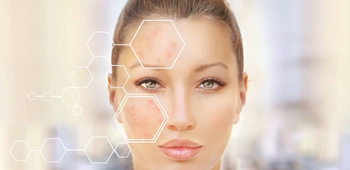 skin immune